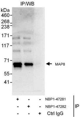 Immunoprecipitation: MAP1S Antibody [NBP1-47282] - MAP1S Antibody Samples:  Whole cell lysate (1 mg for IP, 20% of IP loaded) from HeLa cells.   Antibodies: Affinity purified rabbit anti-MAP8 antibody used for IP at 3 ug/mg lysate.  MAP8 was also immunoprecipitated by rabbit anti-MAP8 antibody NBP1-47281, which recognizes an upstream epitope.  For blotting immunoprecipitated MAP8, NBP1-47281 was used at 1 ug/ml.   Detection: Chemiluminescence with an exposure time of 10 seconds.