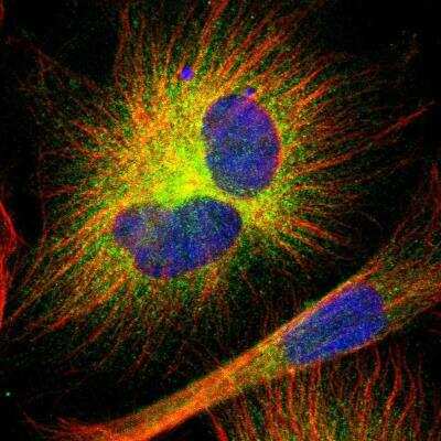 Immunofluorescence: MAP2 Antibody [NBP1-81264] - Immunofluorescent staining of human cell line U-251 MG shows localization to cytosol.
