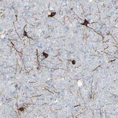 Immunohistochemistry: MAP2 Antibody [NBP1-81264] - Immunohistochemical staining of human cerebral cortex shows moderate to strong cytoplasmic positivity in neuronal cells.