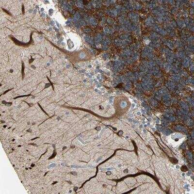 Immunohistochemistry: MAP2 Antibody [NBP1-81264] - Immunohistochemical staining of human cerebellum shows strong cytoplasmic positivity..