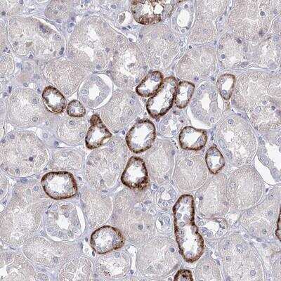 Immunohistochemistry-Paraffin: MAP3K13 Antibody [NBP1-81273] - Staining of human kidney shows strong cytoplasmic positivity in subsets of renal tubules.