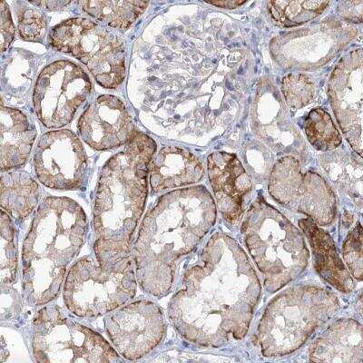 Immunohistochemistry-Paraffin: MAP3K13 Antibody [NBP1-81274] - Staining of human kidney shows moderate membrane and cytoplasmic positivity in cells in tubules.