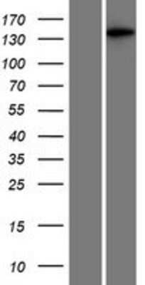 Western Blot: MAP3K6 Overexpression Lysate (Adult Normal) [NBP2-07839] Left-Empty vector transfected control cell lysate (HEK293 cell lysate); Right -Over-expression Lysate for MAP3K6.