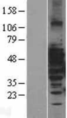 Western Blot: MAP3K8 Overexpression Lysate (Adult Normal) [NBL1-12859] Left-Empty vector transfected control cell lysate (HEK293 cell lysate); Right -Over-expression Lysate for MAP3K8.