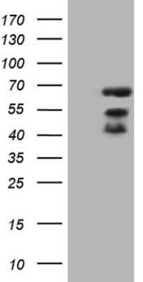 Western Blot: MAP3K8/Tpl2/COT Antibody (3D9) [NBP2-45741] - Analysis of HEK293T cells were transfected with the pCMV6-ENTRY control (Left lane) or pCMV6-ENTRY MAP3K8.