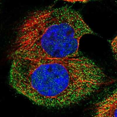 Immunocytochemistry/Immunofluorescence: MAP3K8/Tpl2/COT Antibody [NBP1-86569] - Staining of human cell line A-431 shows localization to cytosol. Antibody staining is shown in green.