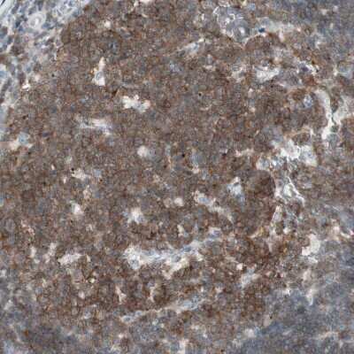 Immunohistochemistry-Paraffin: MAP4K1 Antibody [NBP1-83221] - Staining of human tonsil shows positivity in germinal center cells.