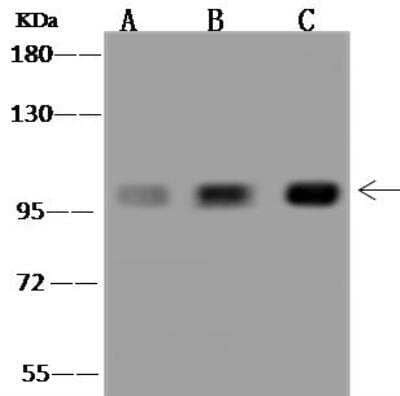 Western Blot: MAP4K1 Antibody [NBP3-12577] - Lane A: Daudi Whole Cell LysateLane B: Raji Whole Cell LysateLane C: Jurkat Whole Cell LysateLysates/proteins at 30 ug per lane.SecondaryGoat Anti-Rabbit IgG (H+L)/HRP at 1/10000 dilution.Developed using the ECL technique.Performed under reducing conditions.Predicted band size:97 kDaObserved band size:97 kDa