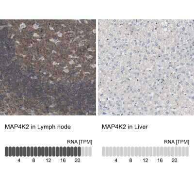 Immunohistochemistry-Paraffin: MAP4K2 Antibody [NBP1-88584] - Staining in human lymph node and liver tissues using anti-MAP4K2 antibody. Corresponding MAP4K2 RNA-seq data are presented for the same tissues.