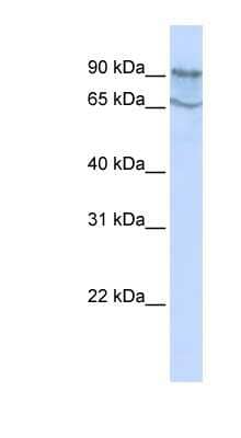 Western Blot: MAP4K2 Antibody [NBP1-58851] - Titration: 0.2-1 ug/ml, Positive Control: HepG2 cell lysate.