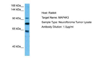 Western Blot: MAP4K3 Antibody [NBP2-83181] - Host: Rabbit. Target Name: MAP4K3. Sample Tissue: Human Neurofibroma Tumor lysates. Antibody Dilution: 1ug/ml