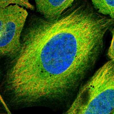 Immunocytochemistry/Immunofluorescence: MAP4K5 Antibody [NBP1-83385] - Staining of human cell line U-2 OS shows localization to plasma membrane & cytosol. Antibody staining is shown in green.