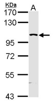 Western Blot: MAP4K5 Antibody [NBP1-31234] - Sample (30 ug of whole cell lysate) A: Molt-4 12% SDS PAGE, diluted at 1:5000.