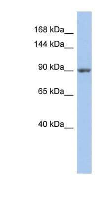 Western Blot: MAP4K5 Antibody [NBP1-58850] - PANC1 cell lysate, concentration 0.2-1 ug/ml.