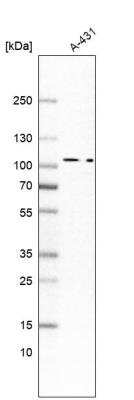 Western Blot: MAP4K5 Antibody [NBP1-83385] - Analysis in human cell line A-431.