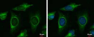 Immunocytochemistry/Immunofluorescence: MAP4K6 Antibody [NBP1-32766] -  HeLa cells were fixed in ice-cold MeOH for 5 min. Green: MAP4K6 protein stained by MAP4K6 antibody [C2C3-2], C-term diluted at 1:500. Blue: Hoechst 33342 staining.