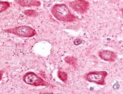 Immunohistochemistry: MAP4K6 Antibody [NLS7412] - Analysis of anti-MAP4K6 antibody with human hippocampus