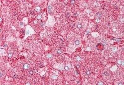 Immunohistochemistry-Paraffin: MAP4K6 Antibody [NBP1-02336] - Staining of Human Liver. Concentration 5 ug/ml.