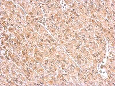 Immunohistochemistry-Paraffin: MAP4K6 Antibody [NBP1-32766] - Paraffin-embedded U87 xenograft; antibody dilution 1:500.