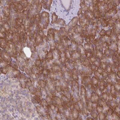 <b>Orthogonal Strategies Validation. </b>Immunohistochemistry-Paraffin: MAP4K6 Antibody [NBP2-49220] - Staining of human pancreas shows moderate cytoplasmic positivity in exocrine glandular cells.