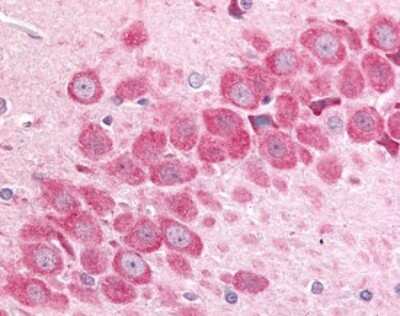 Immunohistochemistry-Paraffin: MAP4K6 Antibody [NLS7412] - Analysis of anti-MAP4K6 antibody with rat hippocampus.