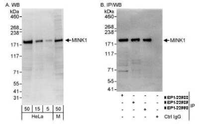 Western Blot: MAP4K6 Antibody [NBP1-22988] - Whole cell lysate from HeLa and mouse NIH3T3 cells. NBP1-22988 used for WB at 0.04 mcg/ml (A) and 1 mcg/ml (B) and used for IP at 3 mcg/mg lysate.