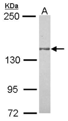 Western Blot: MAP4K6 Antibody [NBP2-17220] - Sample (30 ug of whole cell lysate) A: MCF-7 5% SDS PAGE gel, diluted at 1:1000.