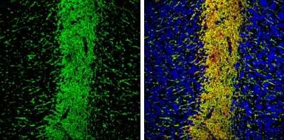 Immunohistochemistry-Frozen: MAP6 Antibody [NBP3-12961] - MAP6 antibody detects MAP6 Protein expression by immunohistochemical analysis. Sample: Frozen-sectioned adult mouse cerebellum. Green: MAP6 stained by MAP6 antibody (NBP3-12961) diluted at 1:250. Red: NF-H, stained by NF-H antibody [GT114] diluted at 1:500. Blue: Fluoroshield with DAPI. Antigen Retrieval: Citrate buffer, pH 6.0, 10 min