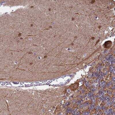 Immunohistochemistry: MAP6 Antibody [NBP2-14221] - Staining of human cerebellum shows strong cytoplasmic and nuclear positivity in Purkinje cells and cells in molecular layer.