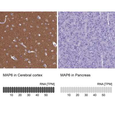 <b>Orthogonal Strategies Validation. </b>Immunohistochemistry-Paraffin: MAP6 Antibody [NBP2-14221] - Staining in human cerebral cortex and pancreas tissues using anti-MAP6 antibody. Corresponding MAP6 RNA-seq data are presented for the same tissues.