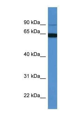 Western Blot: MAP6 Antibody [NBP1-91503] - Hela cell lysate, concentration 0.2-1 ug/ml.
