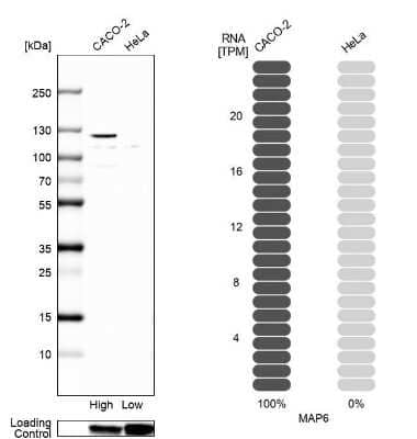 Western Blot: MAP6 Antibody [NBP2-14220] - Analysis in human cell line CACO-2 and human cell line HeLa.