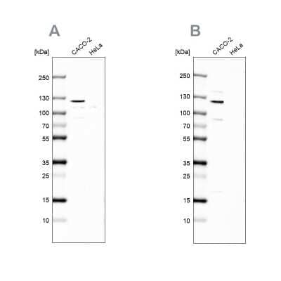Western Blot: MAP6 Antibody [NBP2-14220] - Analysis NBP2-14220 (A) shows similar pattern to independent antibody NBP2-14221 (B).