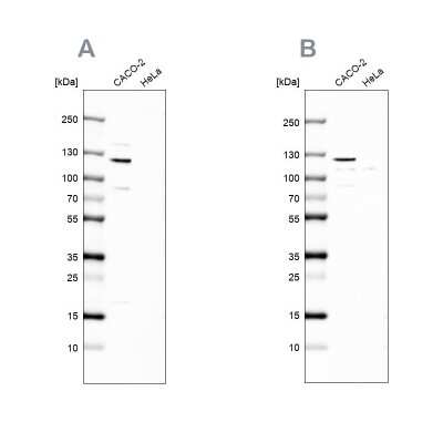 <b>Independent Antibodies Validation. </b>Western Blot: MAP6 Antibody [NBP2-14221] - Analysis NBP2-14221 (A) shows similar pattern to independent antibody NBP2-14220 (B).