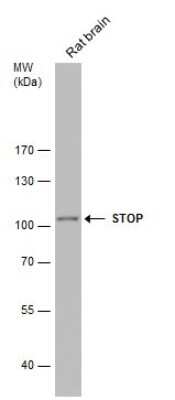 Western Blot: MAP6 Antibody [NBP3-12961] - Rat tissue extract (50 ug) was separated by 7.5% SDS-PAGE, and the membrane was blotted with MAP6 antibody (NBP3-12961) diluted at 1:5000.