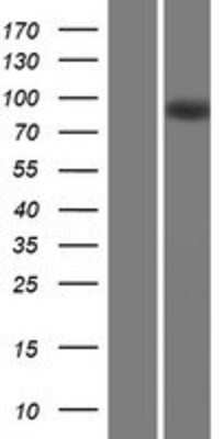 Western Blot MAP6 Overexpression Lysate