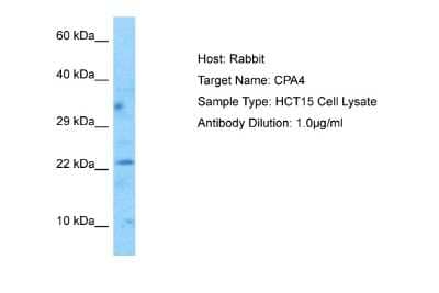 Western Blot MAP6D1 Antibody - BSA Free