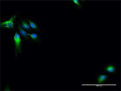Immunocytochemistry/Immunofluorescence: MAP7 Antibody [H00009053-D01P] - Analysis of antibody to MAP7 on HeLa cell. Antibody concentration 30 ug/ml.