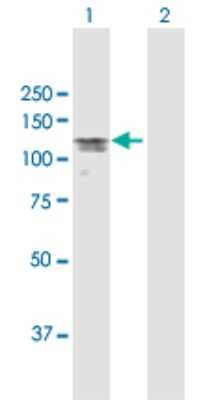 Western Blot: MAP7 Antibody [H00009053-D01P] - Analysis of MAP7 expression in transfected 293T cell line by MAP7 polyclonal antibody.Lane 1: MAP7 transfected lysate(84.10 KDa).Lane 2: Non-transfected lysate.