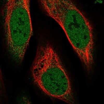 Immunocytochemistry/Immunofluorescence: MAPK1IP1L Antibody [NBP1-88420] - Staining of human cell line U-2 OS shows localization to nucleoplasm &amp; cytosol.