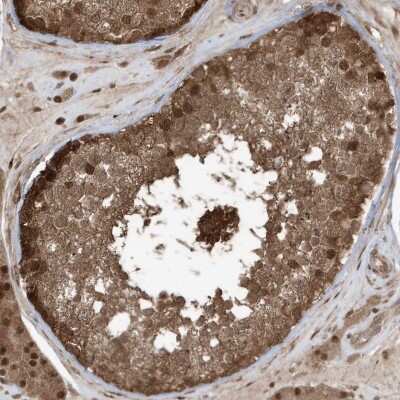 Immunohistochemistry-Paraffin: MAPK1IP1L Antibody [NBP1-88420] - Staining of human testis shows strong cytoplasmic and nuclear positivity in cells in seminiferous ducts.