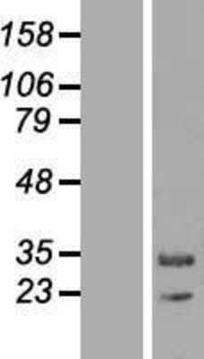 Western Blot: MAPK1IP1L Overexpression Lysate (Adult Normal) [NBL1-12876] Left-Empty vector transfected control cell lysate (HEK293 cell lysate); Right -Over-expression Lysate for MAPK1IP1L.