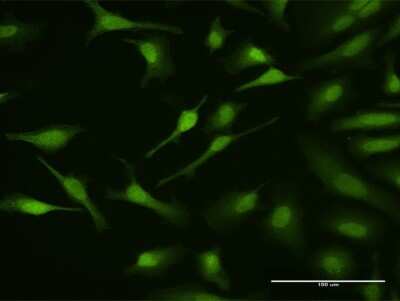 Immunocytochemistry/Immunofluorescence: MAPKAP Kinase 3 Antibody [H00007867-D01P] - Analysis of antibody to MAPKAPK3 on HeLa cell. Antibody concentration 10 ug/ml.