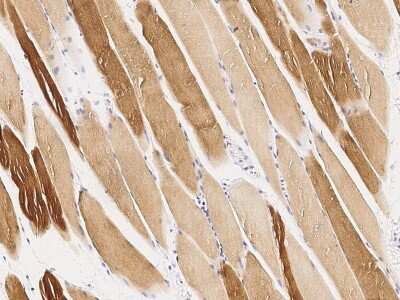 Immunohistochemistry-Paraffin: MAPKAP Kinase 3 Antibody [NBP2-99449] - Immunochemical staining of human MAPKAP Kinase 3 in human skeletal muscle with rabbit polyclonal antibody (1:1000, formalin-fixed paraffin embedded sections).