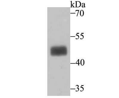 Western Blot: MAPKAP Kinase 3 Antibody (JU30-31) [NBP2-75565] - Analysis of MAPKAP Kinase 2 on SK-Br-3 cell lysate using anti-MAPKAP Kinase 2 antibody at 1/500 dilution.