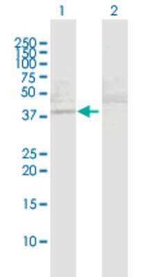 Western Blot: MAPKAP Kinase 3 Antibody [H00007867-D01P] - Analysis of MAPKAPK3 expression in transfected 293T cell line by MAPKAPK3 polyclonal antibody.Lane 1: MAPKAPK3 transfected lysate(43.00 KDa).Lane 2: Non-transfected lysate.