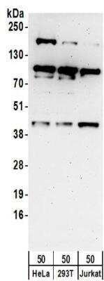 Western Blot: MAPKAP Kinase 3 Antibody [NBP2-32092] - Samples:  Whole cell lysate (50 ug) from HeLa, 293T, and Jurkat cells.  Antibodies:  Affinity purified rabbit anti-MAPKAP Kinase 3 antibody NBP2-32092 used for WB at 0.4 ug/ml.  Detection: Chemiluminescence with an exposure time of 3 minutes.
