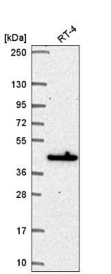 Western Blot: MAPKAP Kinase 3 Antibody [NBP2-58080] - Analysis in human cell line RT-4.