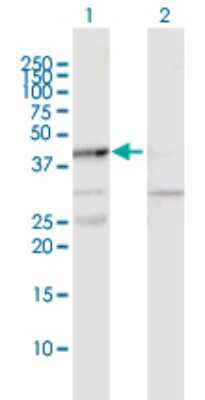 Western Blot: MAPKAPK2 Antibody [H00009261-D01P] - Analysis of MAPKAPK2 expression in transfected 293T cell line by MAPKAPK2 polyclonal antibody.Lane 1: MAPKAPK2 transfected lysate(45.60 KDa).Lane 2: Non-transfected lysate.