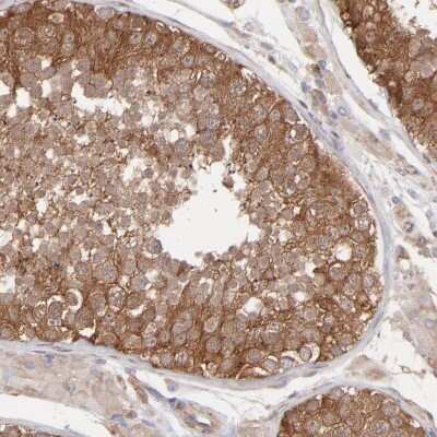 Immunohistochemistry-Paraffin: MAPRE1 Antibody [NBP1-84928] - Staining of human testis shows high expression.